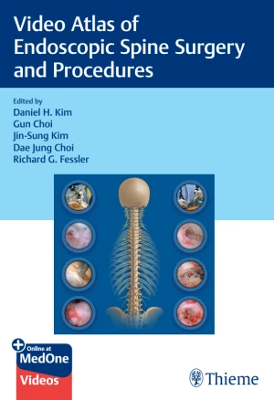 Video Atlas of  Endoscopic Spine Surgery  and Procedures